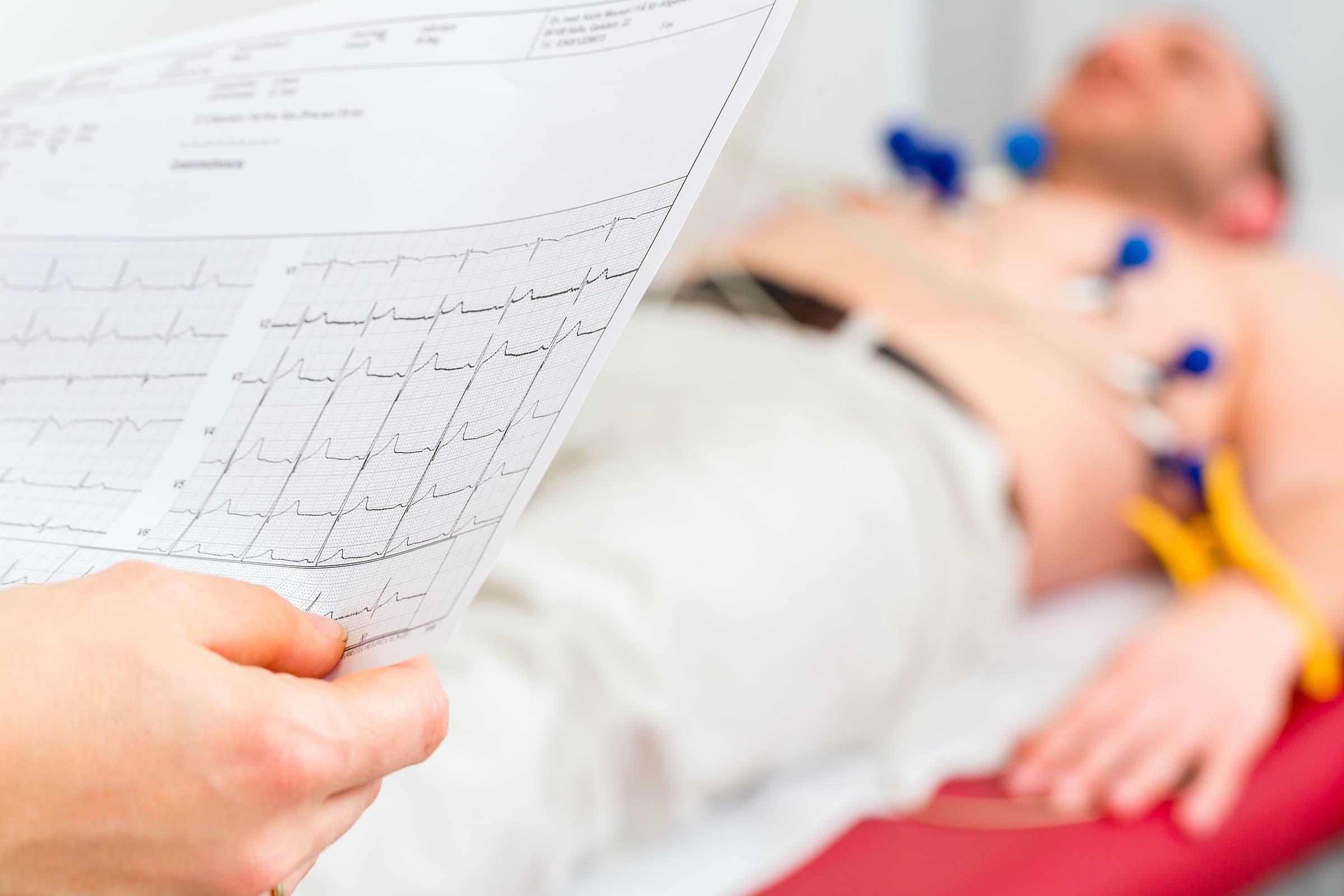 eletrocardiograma