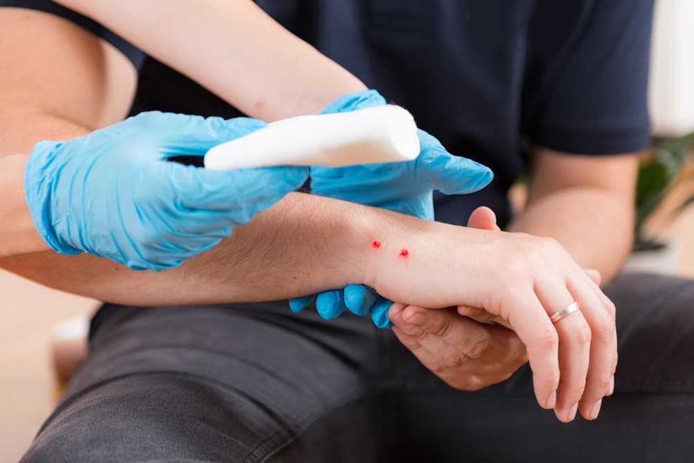 First,Aid,Training,-,Snake,Bite.,First,Aid,Course.
