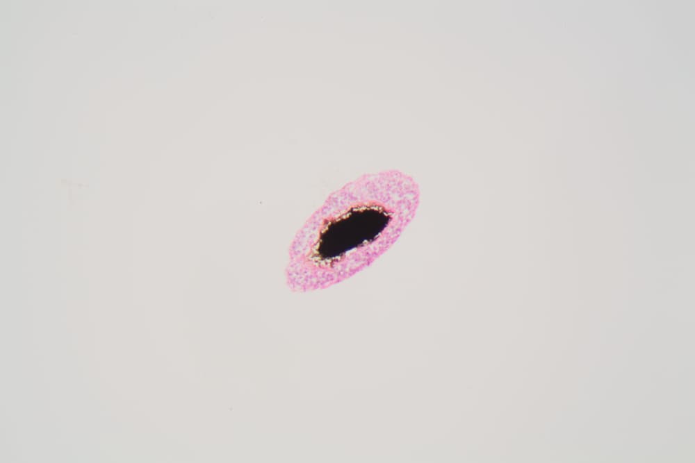 Schistosoma,Mansoni,Under,The,Microscope.,Schistosoma,Mansoni,Is,Human,Parasite