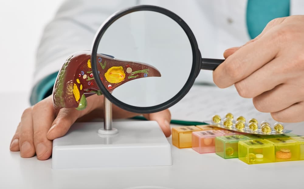 Human,Liver,Disease,,Diagnosis,And,Liver,Treatment.,Doctor,Showing,Liver