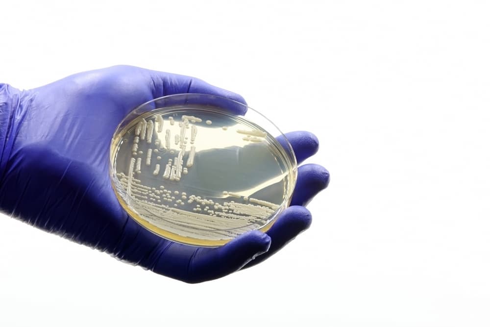 Gloved,Medical,Or,Scientific,Hand,,With,A,Microbiological,Culture,Of